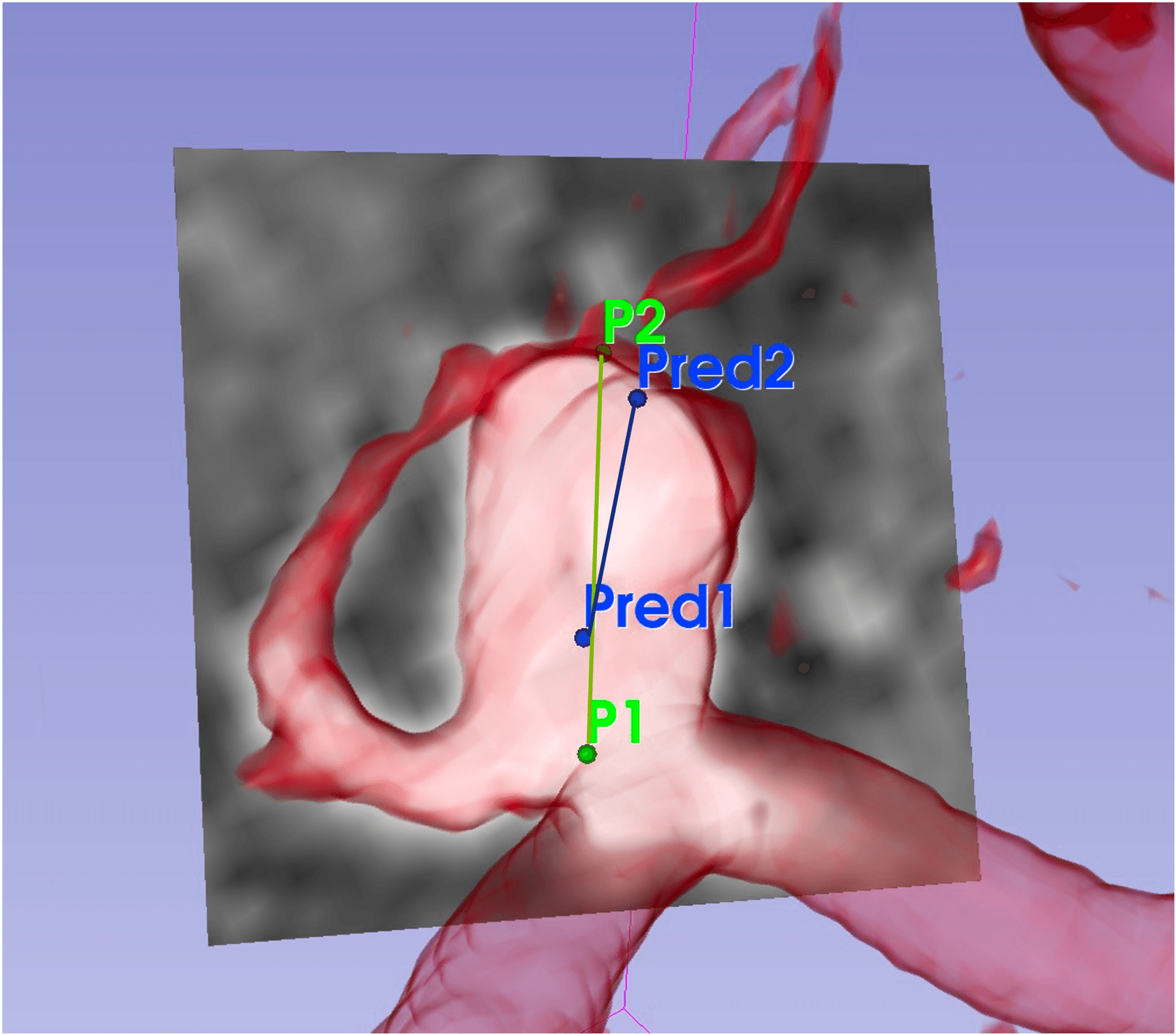 DeepAnePose technical view