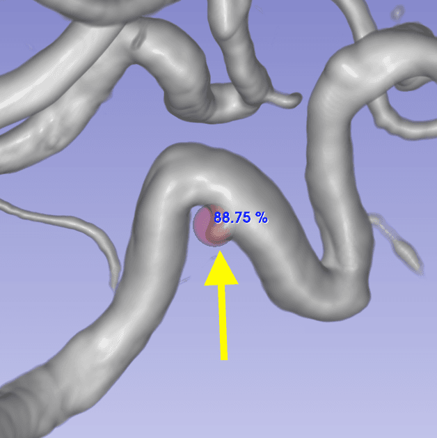 DeepAneDet technical view