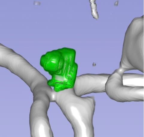 DeepAneSeg technical view